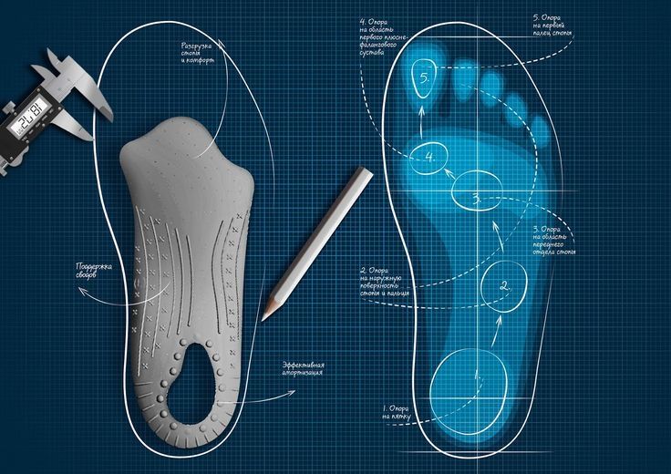 Stop the Roll with the Best Overpronation Insoles
